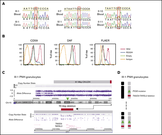 Genetic analyses of the affected patient (III-1) and family members and in vitro functional analysis of the mutant PIGB. (A) The inherited PIGB mutation confirmed by Sanger sequencing in blood cells (homozygous) and somatic cells derived from cervix (heterozygous) of III-1 and in blood cells (heterozygous) from the patient’s mother (II-7) and aunt (II-10). The mutation was not present in blood cells from the daughter (IV-1) or uncle (II-11). (B) Functional analysis of the mutant PIGB cDNA. Mutant PIGB cDNA could not rescue the surface expression of GPI-APs through transient transfection in PIGB-deficient CHO cells. (C) SNP array analysis of chromosome 15q (Chr15) in PNH-type granulocytes from III-1 using CytoScan HD Array. The PNH clone had a CN-LOH region spanning 61 Mbp with a small deletion spanning 70 kbp, including the TM2D3 and TARSL2 genes. (D) Outcome of the CN-LOH in the patient (III-I); the inherited PIGB mutation and microdeletion became homozygous by the somatic CN-LOH.