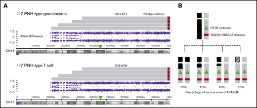 Various PNH clones with CN-LOH regions of different lengths from II-7 (mother). (A) SNP array analysis of chromosome 15q in PNH-type granulocytes and T cells from II-7 using CytoScan HD Array. There were at least 4 clones with different sizes of CN-LOH in PNH cells, and the sizes and number of CN-LOH clones in granulocytes and T cells were almost the same. As the probes for chromosome 15p were missing in the kit, the exact spanning size of the longest CN-LOH was unknown (shaded areas). (B) Percentage of each clone with different sizes of CN-LOH estimated from the pattern of allele differences.