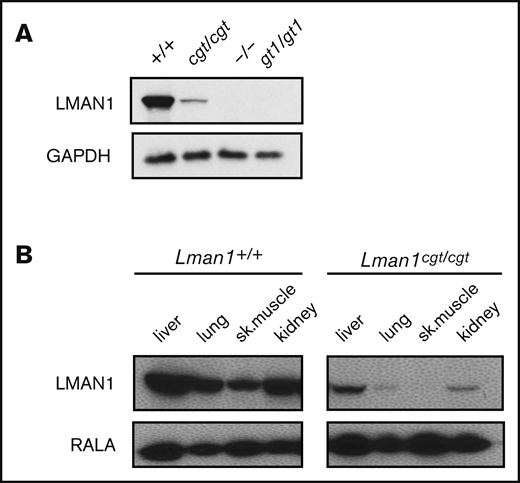 Western blot of LMAN1 expression in Lman1 mutant mice. (A) Western blot of liver lysates from homozygote carriers of the Lman1 mutant alleles: Lman1cgt, Lman1–, and Lman1gt1. (B) Western blot of multiple tissue lysates from wild-type and Lman1cgt/cgt mice. GAPDH, glyceraldehyde-3-phosphate dehydrogenase.