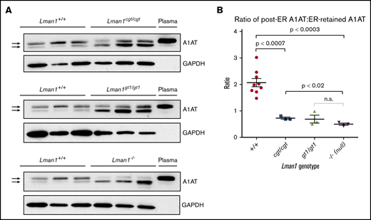 Western blot for A1AT in liver lysates. (A) Liver lysates prepared from Lman1cgt/cgt, Lman1gt1/gt1, Lman1−/−, and Lman1+/+ mice were analyzed by western blotting using an anti-A1AT antibody. The lower A1AT band corresponds to ER-retained A1AT (and was previously shown to be endoglycosidase H sensitive28). The upper A1AT band corresponds to post-ER A1AT and is comparable in molecular weight to secreted plasma A1AT. Each lane corresponds to an individual mouse. (B) The ratio of post-ER A1AT:ER-retained A1AT (upper band:lower band) in the hepatic lysates of each mouse as determined by densitometry; a ratio >1 indicates that the majority of the A1AT has been secreted beyond the ER, whereas a ratio <1 indicates that the majority of the A1AT is retained in the ER. Horizontal lines indicate the mean, and error bars indicate the standard error of the mean for each genotype.