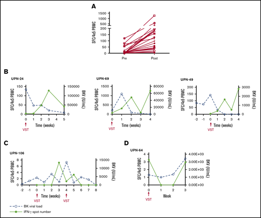 Characteristics of the cellular and viral response. (A) The median number of BKPyV-specific T cells pre- and post-VST infusion. Interferon-γ response and corresponding viral PCR in patients who require 1 VST infusion (B), in a patient requiring multiple VST infusions (C), and in 1 patient who did not respond to VST infusion (D).
