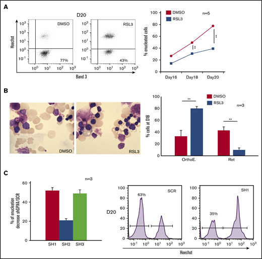 Enucleation impairment induced by GPX4 inhibition and gene silencing. (A, left) Representative Band 3/Hoechst dot plots obtained at day 20 in GPA+ control and 1 µM RSL3-treated cells using FCM (n = 5). (A, right) Curves showing quantification of enucleated GPA+/Hoechst− cells (%) from day 16 to day 20 in 1 µM RSL3 and control treatments (n = 5). Percentage of enucleated cells. DMSO vs RSL3: day 18, 49% ± 4% vs 31% ± 3%, P < .01; day 20, 78% ± 5% vs 39% ± 5%, P < .01. (B, left) May-Grünwald-Giemsa (MGG) staining (magnification ×100) of DMSO or 1 µM RSL3-treated cells. Images shown were taken at day 18 and were representative of 3 independent experiments. (B, right) Cytological count after MGG staining of orthochromatic erythroblasts and reticulocytes (%) in 1 µM RSL3 and control conditions (n = 3). Percentage of RET. DMSO vs RSL3: 43% ± 6% vs 10% ± 3%, P < .01. (C, left) histogram representing the percentage of decrease in day 20 enucleation observed after transduction of 3 different shRNA against GPX4 (SH1, SH2, SH3) in comparison with control (ShSCR) (n = 3). Percentage of enucleation decrease in comparison with SCR. SH1: 52% ± 3%; SH2: 21% ± 2%; SH3: 49% ± 4%, SCR vs each SH: P < .01. (C, right) A representative histogram of Hoechst staining at day 20 in SCR and SH1-transduced cells. **P < .01. Error bars are SEM.
