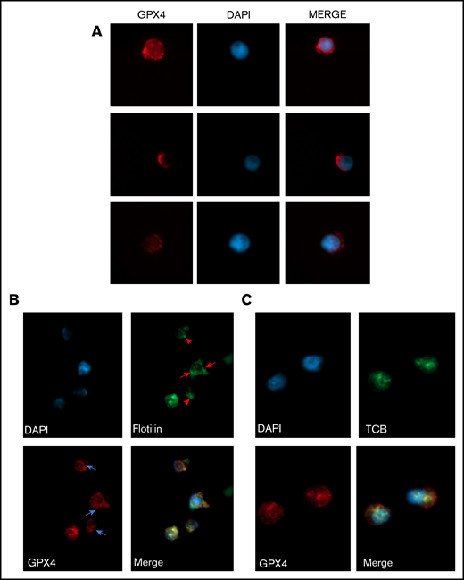 GPX4 had a perinuclear distribution during enucleation and localized with lipid raft markers flotillin and cholera toxin b subunit. (A) Representative image of AlexaFluor 647–conjugated GPX4 immunolabeling and DAPI staining during erythroblast enucleation (n = 3). These images were taken at day 15 of differentiation at 60× original magnification used with oil immersion. (B-C) Representative image of DAPI staining and AlexaFluor 647–conjugated GPX4 and AlexaFluor 488–conjugated Flotillin-2 immunolabeling (B) or AlexaFluor 647–conjugated GPX4 and AlexaFluor 488–conjugated CTB immunolabeling (C) on day 15 at the beginning of enucleation at 60× magnification used with oil immersion (n = 3).