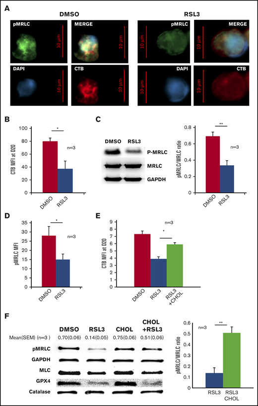 GPX4 inhibition led to disruption of lipid rafts at cleavage furrow and to decrease in myosin phosphorylation that was partially restored by cholesterol. (A) Representative image of DAPI, AlexaFluor 488–conjugated pMRLC, AlexaFluor 647–conjugated CTB staining using fluorescence microscopy in DMSO and 1 µM RSL3-treated cells at day 18 (n = 3). (B) Histogram showing the significant decrease in CTB MFI measured by FCM at day 20 in 1 µM RSL3-treated erythroblasts in comparison with DMSO (n = 3). Mean MFI: 80 ± 5 (DMSO) vs 37 ± 12 (RSL3), P < .05. (C, left) Representative pMRLC immunoblot of erythroblasts treated with DMSO or 1 µM RSL3 during the enucleation stage at day 18. (C, right) Quantification of the decrease in pMRLC induced by 1 µM RSL3 exposure, using the pMRLC/MRLC vs GAPDH ratio (n = 3): 0.69 ± 0.05 vs 0.34 ± 0.06; P < .001. (D) Histogram showing MFI of pMRLC, measured by FCM in fixed and permeabilized erythroblasts in DMSO and 1 µM RSL3 conditions, during the enucleation stage (n = 3). P < .05. (E) Addition of 10 µM cholesterol at day 14 corrected the CTB decrease induced by RSL3 exposure, as assessed by FCM (n = 3). Day 20 erythroblasts, CTB MFI RSL3 vs RSL3 + CHOL: 3.9 ± 0.3 vs 5.9 ± 0.2, P < .05. (F, left) Representative pMRLC and GPX4 immunoblot of erythroblasts treated with DMSO or 1 µM RSL3, with and without 10 µM cholesterol, during the enucleation stage (n = 3). Catalase, MRLC, and GAPDH were used as load controls. (B, right) Densitometric pMRLC/MRLC vs GAPDH ratio between RSL3 and RSL3 + CHOL from 3 independent experiments: 0.137 ± 0.05 vs 0.507 ± 0.06, P < .001. *P < .05; **P < .01. Error bars are SEM.
