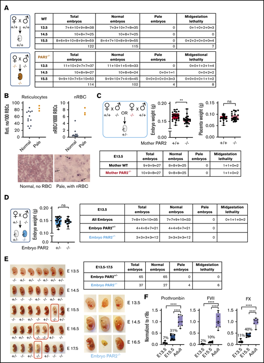 PAR2 deficiency causes a partially penetrant severe embryonic anemia. (A) WT and PAR2−/− embryos were collected between E13.5 and E15.5 from homozygous mating of WT and PAR2−/− parents, and the numbers of normal, pale, and midgestation dead embryos were determined. The number of embryos are shown for individual pregnancies. (B) The numbers of reticulocytes and nRBCs in peripheral blood were counted in 12 normal and 3 pale PAR2−/− embryos at E19.5. Blood smears were stained with Wright solution. Arrows point to nRBC in the blood from 1 of the pale embryos. (C) PAR2+/− embryos were collected at E13.5 from mating of WT or PAR2−/− mother with PAR2−/− or WT father, respectively, and the numbers of normal, pale, and dead embryos, as well as embryo and placenta weight, were determined. Data are mean ± standard deviation (SD). **P < .01, unpaired Student t test; not significant (ns), Mann-Whitney U test. (D) PAR2+/− and PAR2−/− embryos were collected at E13.5 from mating of PAR2+/− mother with PAR2−/− father, and the numbers of normal, pale, and dead embryos, as well as embryo weights, were determined. Data are mean ± SD. ns, unpaired Student t test. (E) We used an independently targeted line to collect PAR2+/− and PAR2−/− embryos at E13.5 to E17.5 from the mating of a PAR2+/− mother with a PAR2−/− father. Examples of PAR2+/− and PAR2−/− embryos with pale (red boxes) or midgestation lethal phenotypes shown. (F) Livers from WT adult mice, as well as fetal livers from WT embryos at E13.5 and E15.5, were collected, and the mRNA expression of coagulation factors prothrombin, FVII, and FX was normalized to r18s as a housekeeping gene. The percentage above the columns shows the relative expression of coagulation factors at each embryonic stage in comparison with adult liver measured in parallel. ****P < .0001, 1-way ANOVA with Dunnett multiple-comparisons test.