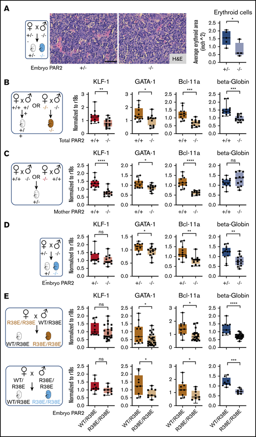 Embryonic PAR2 supports erythropoiesis in the fetal liver. (A) Fetal livers were collected from PAR2+/− and PAR2−/− embryos at E15.5, resulting from the mating of a PAR2+/− mother with a PAR2−/− father, and erythroid cell area was quantified on H&E-stained sections with ImageJ; scale bar, 50 µm. Each point in the graph is the average erythroid cell area from ≥8 field of views per mouse. (B-D) Fetal livers were collected at E13.5 from different timed mating strategies, and mRNA gene expression for erythroid master regulators and β-globin was normalized to r18s. Color coding indicate transcripts changed by maternal and embryonic PAR2 deficiency (beige bars), by only maternal PAR2 deletion (red bars), or by only embryonic PAR2 deletion (blue bars). (E) Expression of the indicated genes in fetal livers collected at E15.5 from WT/PAR2 R38E heterozygous embryos and from PAR2 R38E/PAR2 R38E homozygous embryos in PAR2 R38E/PAR2 R38E homozygous mothers or WT/PAR2 R38E heterozygous mothers. All data are mean ± standard deviation. *P < .05, **P < .01, ***P < .001, ****P < .0001, unpaired Student t test. Mann-Whitney U test was used for for KLF-1 (D) and Bcl-11a and KLF-1 (E, upper row).
