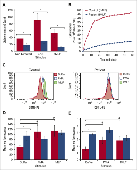 Cell motility, CD11b expression, and F-actin content and assembly. (A) Chemotaxis measured using the under-agarose technique showing distance migrated for each stimulus (mean ± SEM) for the control and patient’s neutrophils, respectively, in 3 to 4 experiments, using independent neutrophil isolation. *P < .05, by 2-tailed Student t test,. (B) Chemotaxis measured using the transmembrane migration technique in response to fMLF. Fluorescence-labeled patient cells and control cell were detected as they crossed the fluorescence-blocking PET membrane into the lower wells in the system. Fluorescence moving into the lower wells is expressed as a percentage of the fluorescence detected in 106 labeled cells and is plotted over time. Directed migration was decreased in the patient’s cells; nondirected migration with buffer was also decreased in the patient’s cells (data not shown). (C) Flow cytometry histogram showing a representative example of CD11b expression for control and patient neutrophils after incubation with buffer, PMA, and fMLF. (D) Cell surface levels of CD11b determined by flow cytometry and presented as mean log fluorescence after incubation with buffer, PMA, and fMLF for the control (red) and patient’s (blue) neutrophils. Bars and brackets represent the mean ± SEM of results in 3 to 5 experiments on independent neutrophil isolations. (E) F-actin assembly was measured as in “Methods” and plotted as mean log fluorescence for buffer, PMA, and fMLF for the control (red) and the patient (blue). The bars and brackets are ±SEM of results in 3 experiments using independent neutrophil isolations. (D-E) *P < .05, patient vs control in a given treatment condition, and #P < .05, given stimulus vs buffer, by 2-tailed Student t test.