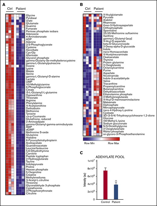 Metabolite levels in resting patient vs control neutrophils. (A) Metabolites decreased in the patient’s neutrophils relative to control cells. (B) Metabolites elevated in the patient’s neutrophils. Results of 3 separate measurements. Differences significant at P < .001. (C) Changes in adenylate pool (sum of ADP, AMP, adenosine, and adenine) between control and patient neutrophils. Data are plotted as means ± standard deviation. **P < .005.
