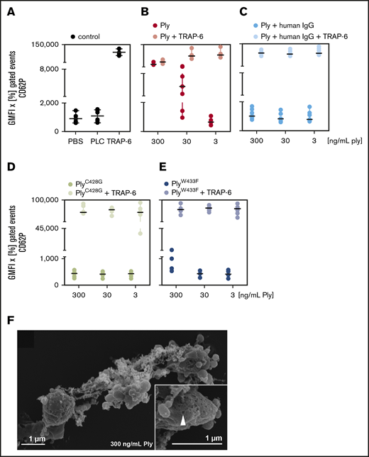 CD62P expression of platelets by pneumolysin is caused by pore formation. Washed platelets of a defined set of 6 donors were incubated with various concentrations of pneumolysin (Ply). CD62P was detected by flow cytometry using antibodies against CD62P (P-selectin). The data are presented as GMFI of the positive gated events multiplied with the percentage of positive gated events in the dot plots. (A) PBS (gray) and phospholipase C (PLC; gray) from Staphylococcus aureus known to not activate platelets13 were used as negative controls and 20 µM TRAP-6 (gray) as positive control. (B) Pneumolysin (red; ng/mL) caused CD62P expression and dose-dependently inhibited an additional response to TRAP-6 (black). (C) Polyvalent human immunoglobulins (human IgG; Privigen) neutralized the effect of pneumolysin (pneumolysin plus human IgG = light blue) (to enable comparison with the experiments without immunoglobulins, the data are shown here, although they are presented in the text at the end of “Results”). (D) PneumolysinC428G without lytic activity (brown) did not activate platelets or impaired the response to TRAP-6 and (E) pneumolysinW433F with ∼10% lytic activity (purple) had a very minor effect only at 300 ng/mL. (F) Visualization of pore formation in the platelet membrane by pneumolysin by scanning electron microscopy. Platelets are altered in their shape and formed vesicles but not pseudopodias. At the left side, a platelet with pores can be seen. Inset, a higher magnification of the platelet indicating a pore by an arrow.