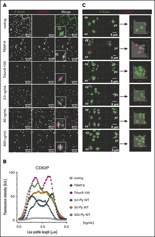 Fluorescence microscopy of pneumolysin-treated platelets. (A) Pneumolysin-treated platelets were stained for F-actin (green) and CD62P (magenta). Platelets were not permeabilized, with the exception of the Triton X-100 control. Insets, Single platelets at higher magnification and the line used for measuring fluorescence intensities shown in panel B. In the presence of 3.0 and 30 ng/mL pneumolysin, intracellular staining of CD62P and α-tubulin become visible. At 200 ng/mL pneumolysin, vesicles staining strongly for pneumolysin surround the platelets (compare Figure 1F). (B) Staining pattern of CD62P throughout single cells treated with pneumolysin was quantified to distinguish between cytoplasmic and only surface-associated CD62P staining. The pattern indicates that CD62P is stained intracellularly and not extracellularly. The different concentrations of pneumolysin used are color coded: 3.0 ng/mL (blue), 30 ng/mL (orange), 300 ng/mL (green). (C) Orthogonal views of confocal Z-stacks and 3D isosurface rendering of pneumolysin-treated platelets stained for F-actin (green) and CD62P (magenta). It shows distinct intracellular accumulation of anti-CD62P antibody in platelets treated with different concentration of pneumolysin and membrane permeabilization with Triton X-100 and surface expression of CD62P upon TRAP-6 stimulation.