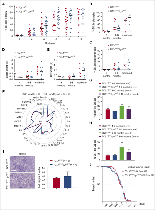 TCL1tg/wtLynup-Bmice show no clear difference in CLL burden compared with TCL1tg/wtmice. (A) Flow cytometric analysis of CD19+ CD5+ CLL cells in the peripheral blood of TCL1tg/wt and TCL1tg/wt Lynup-B mice over 1 year. (B) Flow cytometric analysis of CLL cells in spleens of age-matched and moribund mice. (C) Flow cytometric analysis of CLL cells in bone marrow samples of age-matched and moribund mice. (D) Spleen weights of age-matched and moribund TCL1tg/wt and TCL1tg/wt Lynup-B mice. (E) Liver weights of age-matched and moribund TCL1tg/wt and TCL1tg/wt Lynup-B mice. (F) Cytokine profile in sera of 6 TCL1tg/wt and TCL1tg/wt Lynup-B mice. Data represent mean values (pg/mL). (G) Flow cytometric analysis of in vivo BrdU incorporation rate in splenic CLL cells of mice at 4 to 5 months and 8 to 10 months 16 hours after injection of BrdU. (H) Flow cytometric analysis of Ki67+ splenic CLL cells of young (4- to 5-month old) and old (8- to 10-month old) mice. (I) Representative immunohistochemical staining of cleaved caspase-3 (cl. casp. 3) from sections of spleens from TCL1tg/wt and TCL1tg/wt Lynup-B mice. Scale bars represent 100 µm. Quantification of cleaved caspase-3–positive cells represent means ± SEM of 3 TCL1tg/wt and 4 TCL1tg/wt Lynup-B mice. (J) Kaplan-Meier curves representing the overall survival of TCL1tg/wt and TCL1tg/wt Lynup-B mice from birth to moribund.