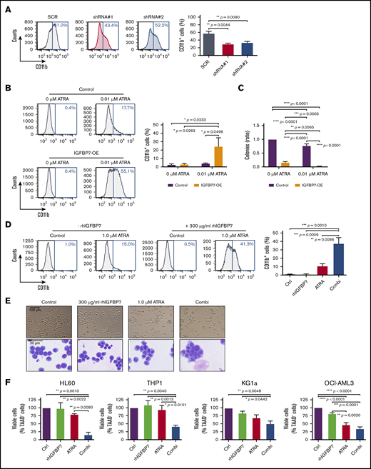 Enhanced IGFBP7 expression sensitizes APL cells to physiological concentrations of ATRA, and rhIGFBP7 potentiates ATRA-induced differentiation, inhibition of proliferation, and apoptosis in non-APL AML cells. For all experiments, AML cells were cultured in low serum condition and stimulated with PBS (Control/Ctrl), 300 µg/mL rhIGFBP7, 1.0 µM ATRA, or the combination (Combi) for 96 hours unless stated otherwise. Differentiation (membrane CD11b expression), proliferation, and apoptosis were measured using flow cytometry, and data are plotted as mean ± SEM. (A) Percentage of differentiation in NB4 cells, transduced with IGFBP7 shRNAs (#1 and #2) or scrambled (SCR) shRNA, after stimulation with 0.5 µM ATRA. P values were determined using 1-way ANOVA with post hoc Dunnett multiple-comparison test. (B-C) NB4 cells, transduced with control or IGFBP7-expressing (IGFBP7-OE) vectors, were stimulated with 0.01 µM ATRA. (B) Percentage increase in CD11b expression. (C) CFU assay (in duplicate), normalized against untreated control. (D) CD11b expression in HL60 cells, quantified relative to flow count beads. (E) Morphology of HL60 cells after stimulation for 72 hours, analyzed using a bright-field microscope (upper panels) and by May-Grünwald-Giemsa staining (lower panels). (F) Viability of AML cell lines after stimulation for 72 hours (HL60 and OCI-AML3 cells) or 120 hours (THP1 and KG1a cells) with rhIGFBP7, ATRA, or the combination, normalized against untreated control. (G) AnnexinV+ THP1 cells after stimulation for 120 hours. (H) Percentage of apoptotic (AnnexinV+ and 7AAD+) THP1 cells (left panel) or OCI-AML3 cells (right panel) after stimulation for 120 hours, quantified relative to flow count beads. Graphs are representative of ≥3 independent experiments. *P < .05, **P < .01, ***P < .001, ****P < .0001, 1- or 2-way ANOVA with post hoc Tukey’s multiple-comparison test, unless stated otherwise.