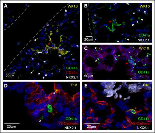 Adult lung MKs are localized to the alveolar interstitium of the distal lung, and fetal lung MKs are found intra- and extravascularly. (A-C) Immunofluorescent staining of 5- to 6-µm fixed-frozen week-10 (WK10) adult mouse lung sections stained for markers of MKs (CD41a and CD42d), lung epithelial cells (NKX2.1), alveolar type 1 epithelial cells (PDPN), and nuclei (Hoechst). Lung borders and an alveolar airspace are outlined with gray dashes. Multinucleated adult lung MKs were preferentially localized to the interstitium of the alveolar septum between neighboring alveoli. (D-E) Immunofluorescent staining of 5- to 6-µm fixed-frozen E13 fetal mouse lung sections stained for VE-Cadherin (endothelial cell marker), CD41a, NKX2.1, and Hoechst. Fetal lung MKs were identified in the developing lung in extravascular (D) and intravascular (E) spaces. Platelets were notably less prevalent in the fetal lung. White and red arrows highlight platelets and MKs, respectively.