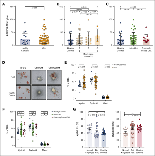 Functional characterization of PB CD34+progenitor cells from patients with CLL. (A-C) Bar plots showing the absolute number of colony-forming units (CFU) generated in methylcellulose assays by PB CD34+ of (A) healthy controls (n = 17) and of patients with CLL (n = 55) (unpaired Student t test; P < .05). Comparison between healthy controls and Binet groups (B) or treatment-naive patients with CLL vs treated patients (C) (ordinary 1-way ANOVA followed by unpaired Student t tests). Differentiated colonies were counted and scored based on morphology 14 days postculture in humid environment at 37°C. Colonies were analyzed using STEMVision (STEMCELL Technologies). (D) Representative pictures of CFUs generated by healthy or CLL-derived hematopoietic progenitors. BFU-E, burst forming unit–erythroid; CFU-GEMM, colony-forming unit–granulocyte, erythrocyte, macrophage, megakaryocyte; CFU-GM, colony-forming unit–granulocyte, macrophage. (E-F) Dot-plots showing the composition of CFUs generated by healthy controls and patients with CLL (E) or by naive patients with CLL or treated patients with CLL (F) (1-way ANOVA followed by unpaired Student t test). (G) Histograms showing myeloid (left) or erythroid (right) CFU frequencies in CLL samples clustered based on chromosomal abnormalities. P values from unpaired Student t tests or 1-way ANOVA are denoted with asterisks according to the following: ***P < .001, *P < .05.