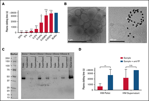 Coagulant activity of human milk (HM). (A) Dilutions of HM (n = 6) were added to human plasma as described in “Methods.” Percentages shown are the final concentrations of HM (vol/vol). (B) Images of EVs from milk labeled with annexin V–gold nanoparticles at 2 magnifications: scale bar 1 µm and 100 nm. At higher magnification, the characteristic lipid bilayer of EVs is visible. (C) Milk was fractionated by ultracentrifugation, and presence of TF was determined by western blot for all donors. Human brain lysate was used as positive control. TF was detectable in the pellet and below the detection limit in the supernatant. (D) Milk-, pellet-, and supernatant-induced (1% final concentration; vol/vol) clotting of plasma in the absence and presence of anti-TF. *P < .05, **P < .01, ***P < .001. CF, carbon film; n.s., nonsignificant.