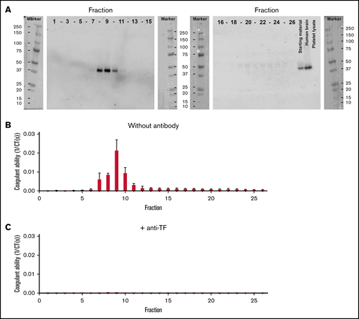 TF is associated with EVs in human milk. (A) Human milk was fractionated by Sepharose 2B SEC, and all fractions were blotted for TF. Blots also show human brain lysate (positive control) and platelet lysate (negative control). All fractions were tested for their ability to trigger clotting of human plasma in the absence and presence of anti-TF (panels B and C, respectively).