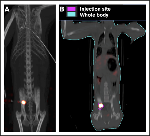 Retention of cells in the IB space by PET/CT imaging following OIB injection with89Zr-oxine–labeled CD34+cells. Right posterior superior iliac spine of a 10 kg of RM was injected using the OIB method with 48.1 kBq (1.3 µCi)/2.9 × 106 (0.29 × 106/kg) labeled autologous CD34+ HSPCs. PET/CT imaging and quantification of isotope uptake from cells at the injection site and whole body was then performed. (A) Images at 10 minutes after OIB injection. (B) Regions of interest (ROIs) as a tool to calculate uptake at different anatomical sites as a percentage of injected dose: 1 hour after injection, 78% of injected cells were retained at the injection site with ∼15% distributed to liver/spleen/other marrow sites. The remaining 7% activity was detected mainly in the kidneys and bladder, consistent with deferoxamine chelation and urinary excretion of free 89Zr released from dead or dying cells.