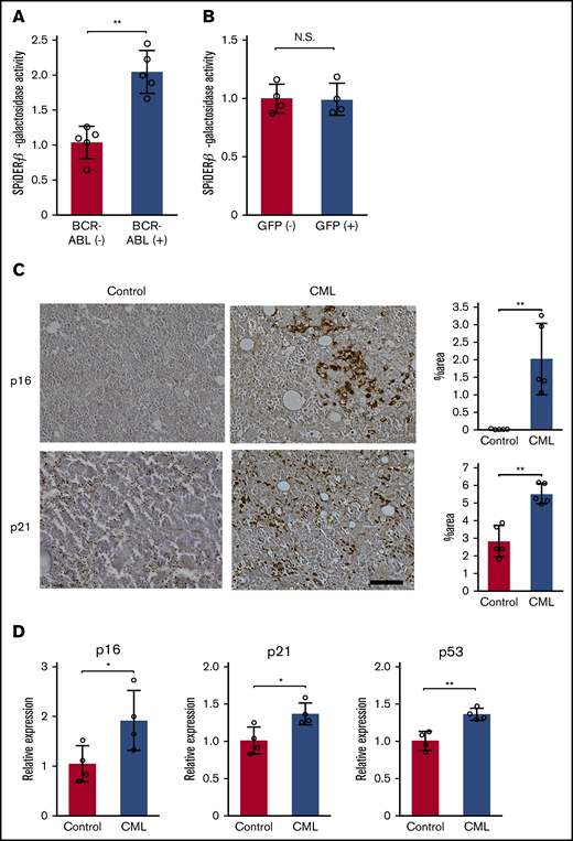 BCR-ABL induces oncogene-induced senescence (OIS) in CML mouse model. (A-B) Quantitative assessment of SPiDER-β-galactosidase activity in BM obtained from CML mice (A) and mice that were transplanted with GFP-transduced KLS+ cells (B). BCR-ABL+ or BCR-ABL− cells were purified from total BM cells obtained from LIC recipients 3 weeks following the BM transplantation (n = 5). GFP+ or GFP− cells were purified from the total BM cells 18 days after the BM transplantation with GFP-transduced KLS+ cells (n = 4). SPiDER-β-galactosidase activity was determined in each purified cell fraction, and normalized to the averaged value of BCR-ABL− cells or GFP− cells. (C) Immunohistochemical analysis of p16 and p21 expression in BM. BMs were obtained from LIC recipients 3 weeks after the transplantation or from age-matched untreated mice, and immunostained with either anti-p16 or anti-p21 antibodies. Representative results from 5 mice are shown on the left (original magnification, ×100; scale bar, 50 μm). Positive areas were quantified in 5 individual animals as described in "Materials and methods" (right). (D) Expression levels of senescence-related genes in BM. Total RNA was extracted from BMs obtained from the LIC recipients 3 weeks after the transplantation or from age-matched untreated mice, and subjected to qRT-PCR (n = 5). The expression level was calculated relative to Gapdh gene and was subsequently normalized to the averaged value of the control. Data are presented as the mean ± standard deviation (SD). Statistical significance was evaluated using the 2-sided Student t test. *P < .05; **P < .01. N.S., not significant.