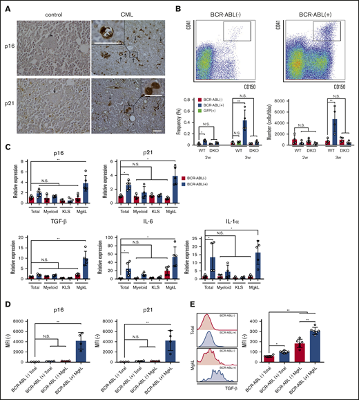Expansion of BCR-ABL+senescent MgkL cells expressing TGF-β in BM of CML mouse. (A) Immunohistochemical staining of BM obtained from CML or untreated mice. BMs were obtained from LIC recipients 3 weeks after the transplantation and subjected to immunohistochemical analysis using anti-p16 (upper) or anti-p21 antibodies (lower). Representative results from 5 individual experiments are shown. Arrows indicate the cells which were morphologically identified as megakaryocytes. Original magnification, ×200. Insets indicate high-power magnification images (×400). Scale bars, 50 μm. (B) CD150+CD41+ MgkL cells in the BM from LIC recipient mice or the mice transplanted with control GFP-transduced KLS+ cells. BMs were obtained from WT- or DKO-derived LIC recipients or the mice transplanted with control GFP-transduced KLS+ cells at the indicated time intervals after the transplantation. Flow cytometric analysis was conducted. Upper panels show representative results obtained from 4 WT-derived LIC recipients 3 weeks after the transplantation. Lower panels show the proportion (left) and absolute numbers (right) of CD150+CD41+ MgkL cells in BCR-ABL+ or BCR-ABL− populations (n = 4). (C) Expression of senescence-associated and SASP-related molecules. BM cells were obtained from WT-derived LIC recipients 3 weeks after the transplantation and fractionated according to expression level of BCR-ABL and surface markers. Total RNA was extracted from the obtained cell fractions and subjected into qRT-PCR to determine senescence-associated (upper) and SASP-related molecules (lower) (n = 4 or 5). The expression level was calculated relative to Gapdh gene and normalized to the averaged value of BCR-ABL− total cells. (D) Protein expression of intracellular p16 and intranuclear p21. Mean fluorescence intensities (MFIs) were determined in each fraction (n = 4). (E) Intracellular TGF-β1 expression. MFIs were determined for each fraction (n = 6). Data are presented as the mean ± SD. Statistical significance was evaluated using 1-way analysis of variance (ANOVA) with Tukey’s multiple-comparisons test. *P < .05; **P < .01.