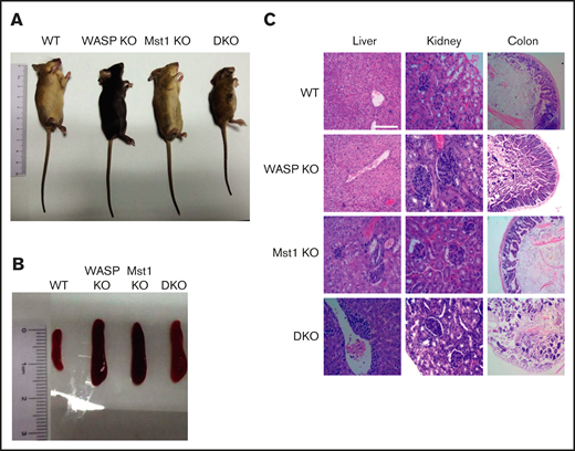 WASP and Mst1 are indispensable for the development of the mice and critical to control inflammation. Images of WT, WASP KO, Mst1 KO, and DKO mice (A) and spleen (B) from WT, WASP KO, Mst1 KO, and DKO mice at 2 months of age (n = 5). (C) Hematoxylin and eosin staining of liver, kidney, and colon from WT, WASP KO, Mst1 KO, and DKO mice. Data are representative of at least 2 independent experiments.