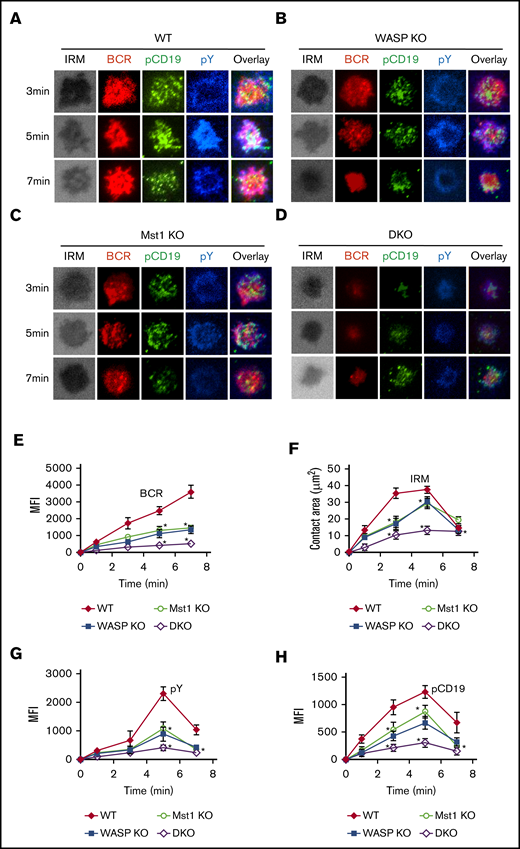 BCR cluster formation, B-cell spreading, and BCR signalosomes are reduced in DKO B cells. Splenic B cells were incubated with AF546-mB-Fab′-anti-Ig tethered to lipid bilayers at 37°C for indicated times (n = 4). Cells were fixed, permeabilized, and stained for pCD19 and pY. Shown are representative images (A-D) and the average values (± standard deviation) of the MFI of the BCR (E), B-cell contact area (F), the MFI of pY (G), and the MFI of pCD19 (H) in the contact zone. The data were generated by using 20 to 90 cells from 3 independent experiments. Scale bars, 2.5 μm. One-way analysis of variance with the Tukey test was used to perform multiple group comparisons; *P < .01.
