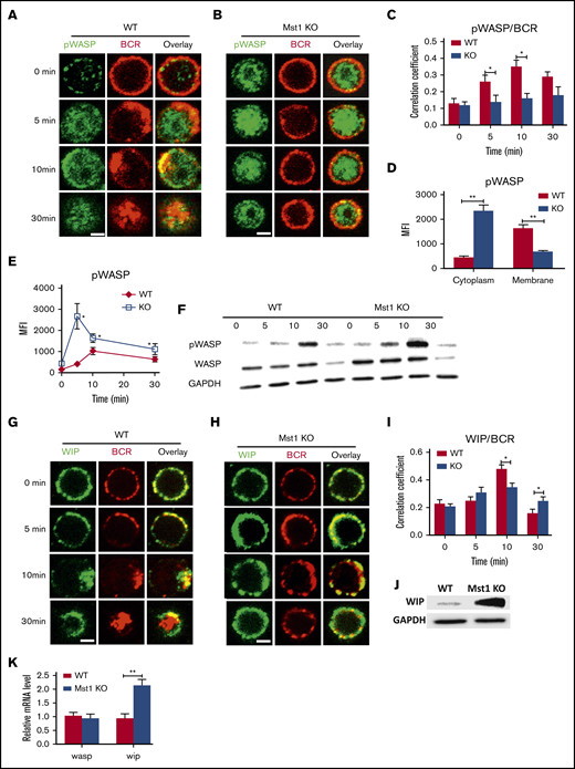 The levels of pWASP are increased in Mst1 KO B cells via promoting the expression of WIP. Splenic B cells were incubated with AF546-mB-Fab′-anti-Ig without (−) or with streptavidin (sAg) at 4°C, washed, and warmed to 37°C for varying lengths of time (n = 4). After fixation and permeabilization, the cells were stained for pWASP and WIP and analyzed by using confocal microscopy (A-B and G-H). The Pearson’s correlation coefficients between BCR and pWASP staining in sAg-stimulated cells were determined by using NIS-Elements AR 3.2 software (C). The levels of pWASP in the cytoplasm and membrane of B cells stimulated with sAg at 5 minutes were quantified by using NIS-Elements AR 3.2 software (D). Flow cytometry or western blot analysis of the WASP and pWASP expression of B cells stimulated with sAg with varying lengths of time (E-F). (I) Pearson’s correlation coefficients between BCR and WIP staining in sAg-stimulated cells were determined by using NIS-Elements AR 3.2 software. (J) Western blot analysis of WIP in WT and Mst1 KO B cells. (K) Real-time polymerase chain reaction analysis of wasp and wip in unstimulated WT and Mst1 KO B cells; the mRNA expression level of wasp and wip from different samples was standardized by glyceraldehyde-3-phosphate dehydrogenase (GAPDH). Shown are the results from 3 independent experiments and representative images at indicated times and the average values (± standard deviation) of ∼50 cells from 3 independent experiments. Scale bars, 2.5 μm. One-way analysis of variance with the Tukey test was used to perform multiple group comparisons; *P < .01, **P < .001.