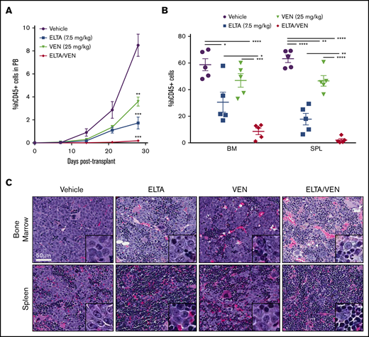 Combination of eltanexor and venetoclax eliminates leukemia cells in an MV-4-11 AML xenograft model. An MV-4-11 model was used to test the in vivo effects of eltanexor (ELTA), venetoclax (VEN), and their combination (ELTA/VEN) treatment compared with vehicle. (A) Percentage of human CD45+ (hCD45+) cells in the peripheral blood (PB) from day 7 to day 28 posttransplantation. **P < .01 and ***P < .001, compared with vehicle at day 28. (B) Percentage of hCD45+ cells in the bone marrow (BM) and spleen (SPL) tissues at day 28 posttransplantation. (C) Hematoxylin and eosin staining of bone marrow and spleen from the mice in panels A and B treated with vehicle, eltanexor, venetoclax, or eltanexor-venetoclax combined. Scale bar, 50 µm. Histology images were acquired with an Aperio AT Turbo scanner at an original magnification of ×40; inset box, original magnification, ×100. The data represent the mean of 5 mice per cohort ± SD. *P < .05; **P < .01; ***P < .001; ****P < .0001.