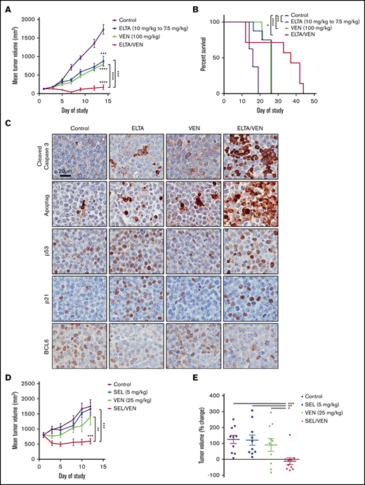 SINE-venetoclax combination inhibits tumor growth and prolongs survival in DLBCL mouse xenograft models. (A) A DoHH-2 xenograft model was used to test the in vivo efficacy of treatment with eltanexor, venetoclax, or eltanexor-venetoclax combined compared with vehicle control. The data represent the mean of 6 to 8 mice per cohort ± standard error of the mean (SEM). (B) Kaplan-Meier survival of mouse cohorts (n = 7-8 mice each), indicating median survival for mice treated with vehicle (16 days), eltanexor (26 days), venetoclax (26 days), or eltanexor-venetoclax combined (37 days). (C) Representative immunohistochemical staining of tumor sections for expression of cleaved caspase 3, ApopTag, p53, p21, and BCL6 from DoHH-2 xenograft mice in panel A. Scale bar, 20 µm. Histology images were acquired with an Aperio AT Turbo scanner at 20× magnification. (D) A Toledo xenograft model was allowed to grow to an average volume of 800 mm3 before testing the in vivo efficacy of treatment with selinexor, venetoclax, or selinexor-venetoclax combined compared with vehicle. The data represent the mean of 10 mice per cohort ± SEM. (E) The percentage change of the vehicle and 3 treatment groups on day 12 was normalized to the baseline measurement of each group on day 1 of treatment. The data represent the mean of 10 mice per cohort ± SEM. *P < .05; **P < .01; ***P < .001; ****P < .0001.