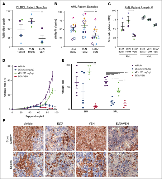 Synergistic anti-tumor effects of eltanexor and venetoclax in primary AML and DLBCL samples ex vivo and in an AML patient-derived xenograft. AML and DLBCL mononuclear cells were treated ex vivo with threefold dilutions of eltanexor, venetoclax, or eltanexor-venetoclax combined for 48 hours. The viability of treated cells compared with DMSO control using the CellTiter-Glo assay was plotted for the indicated concentrations. Viability was significantly decreased after 48 hours of treatment with combined eltanexor-venetoclax in DLBCL (A) or AML (B) cells. (C) Apoptosis was measured in AML or normal (NML) blast cells (SSClo/CD45mid/CD33+) by AnnV/PI staining using flow cytometry after 24 hours of treatment. The percent of live cells (AnnV–/PI–) relative to DMSO was measured. Data are expressed as mean ± SEM. Individual patients are represented by specific shapes in panels A-C, and individual AML patients who were venetoclax-responsive (orange) or primary induction refractory (lavender) in the clinic are represented by colored symbols in panels B and C. (D-E) An AML patient-derived xenograft model was used to test the in vivo effects of treatment with eltanexor, venetoclax, or eltanexor-venetoclax combined compared with vehicle. (D) Percentage of hCD45+ cells in the PB from day 28 to day 93 posttransplantation. The data represent the mean of 5 mice per cohort ± SEM. *P < .05 and ***P < .001, compared with vehicle at day 93. (E) Percentage of hCD45+ cells in the bone marrow and spleen tissues at day 93 posttransplantation. The data represent the mean of 5 mice per cohort ± SEM. (F) Representative immunohistochemical staining of bone marrow and spleen sections for expression of hCD45 from mice with AML patient-derived xenografts in panels D and E. Scale bar, 20 µm. Histology images were acquired with an Olympus BX43F microscrope at 40× magnification. *P < .05; **P < .01; ****P < .0001.
