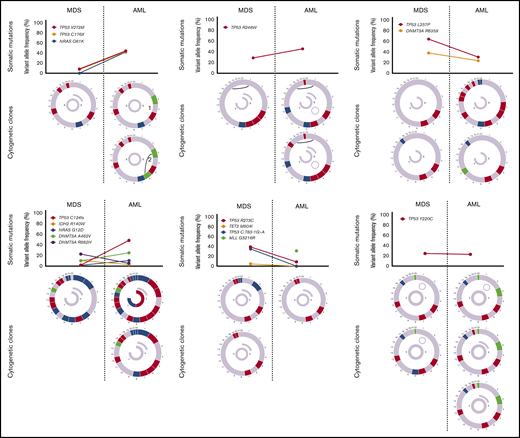 Cytogenetic evaluation and next-generation sequencing at baseline and time of transformation to AML. For each section of the figure, the upper graph represents VAF of detectable mutations at the time of diagnosis of MDS and at transformation. Lower graphs represent gain (blue) or loss (red) of chromosomal material and translocations (thin black lines connecting chromosomes) present at diagnosis or transformation. A partial semicircle present in the upper right corner of sexual chromosomes in some patients represents marker chromosomes. Inversions or derivatives are shown in green.