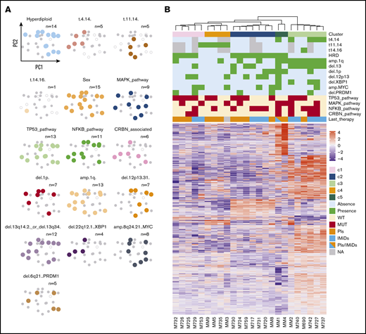 Transcriptomic profile of RRMM patients. (A) Principal component analysis based on genetic features: samples are represented as dots in the space identified by the 2 principal components and are color-coded based on the presence or absence of the genetic feature listed in the top label: color: present; gray, absent; empty, information not available. (B) Unsupervised clustering of the samples based on their gene expression profile. Genomic features are annotated above the horizontal white line (green, cytogenetic events; red, mutations), as is last treatment (yellow, bortezomib; light blue, lenalidomide).