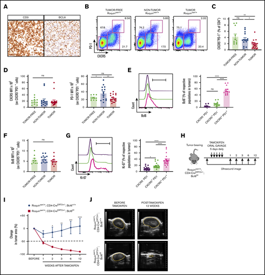 Disruption of functional Bcl6 gene in growing AITL-like tumors leads to tumor regression. (A) Exemplary immunohistochemistry sections of AITL patient samples depicting CD3 and Bcl6 expression. (B) Representative flow cytometric plots showing subsets of CD4 cells based on expression of PD-1 and CXCR5. (C) Comparing frequencies of CD4+CXCR5+PD-1+ cells between tumor-free, nontumorous (non-tumor), and tumorous (tumor) samples (n = 11 tumor-free; n = 15 nontumorous; and n = 21 tumorous samples). (D) MFI of CXCR5 and PD-1 on CD4+CXCR5+PD-1+ cells (n = 11 tumor-free; n = 15 nontumorous; and n = 21 tumorous samples). Bcl6 expression in CXCR5−PD1−, CXCR5+PD-1−, and CXCR5+PD-1+ cells from tumor samples (E) and Bcl6 MFI of CD4+CXCR5+PD-1+ cells (F) (n = 9 tumor-free; n = 12 nontumorous; and n = 13 tumorous). (G) Representative histogram and frequency of Ki-67 levels in tumor CD4+ subsets (n = 21 tumorous). (H) Roquinsan/+ mice were bred with a CD4-specific, tamoxifen-inducible Cre-recombinase to target the Bcl6 gene (Roquinsan/+; Cd4-CreERT2+/−; Bcl6f/f). Representative time course (I) and sonograms (J) demonstrating tumor regression in mice with Bcl6 gene deletion (n = 5 Roquinsan/+; Cd4-CreERT2+/−; Bcl6+/+; n = 6 Roquinsan/+; Cd4-CreERT2+/−; Bcl6f/f). Error bars in panels C-G,I represent the SEM. Data are pooled from at least 2 independent experiments. *P < .05; **P < .01; ***P < .001; ****P < .0001.