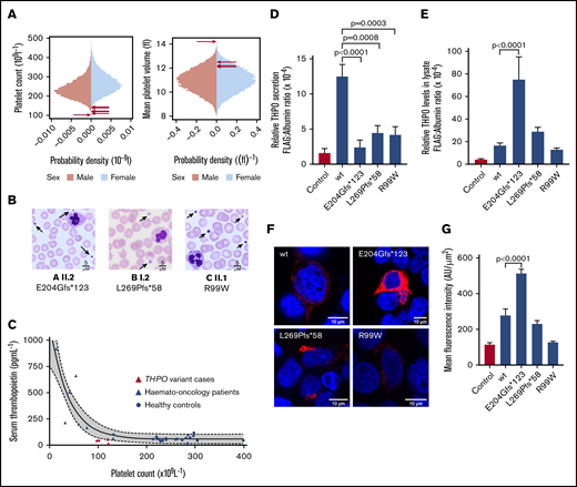 Phenotypic characteristics of monoallelic THPO variants and expression in HEK293T cells. (A) Sex-stratified graphs of PLT and mean platelet volume obtained using a Sysmex XN-Series hematology analyzer from 48 345 blood donors from the INTERVAL study.17 The arrows indicate the platelet parameters of the cases harboring THPO variants. (B) Representative May-Grünwald-Giemsa–stained peripheral blood films from THPO variant cases confirming thrombocytopenia and indicating that some platelets (arrows) were enlarged. Scale bars, 5 μM. (C) Serum TPO concentration plotted against platelet counts in healthy controls or hemato-oncology patients with thrombocytopenia caused by bone marrow suppression after chemotherapy. Corresponding data from 4 cases with THPO variants (A I.1 and II.2, B I.2, C II.1) are also shown. The solid and dotted lines represent the line of best-fit and 95% confidence intervals, respectively, from a nonlinear regression of control data. (D) Effects of THPO variants in HEK293T cells: Flag-tagged WT, E204Gfs*123, L269P*58, or R99W substituted TPO was expressed in HEK293T cells by transient transfection. Secretion of FLAG-tagged TPO in cell supernatant (D) and lysate (E) was measured using an ELISA and normalized against total protein in the cell lysate. Results are mean ± standard error from ≥5 independent experiments. The P values were calculated using 1-way analysis of variance. (F) Representative images from HEK293T cells transfected with WT and variant THPO cDNAs and stained with an antibody against the FLAG epitope (red). Nuclei were stained with 4′,6-diamidino-2-phenylindole (blue). Images were captured using a Leica SP5 II confocal microscope with a 63×/1.4 NA lens and analyzed with ImageJ/Fiji. All images are shown with the same intensity range. (G) Quantification of FLAG-tagged protein by mean fluorescence intensity in representative cells (n = 5).