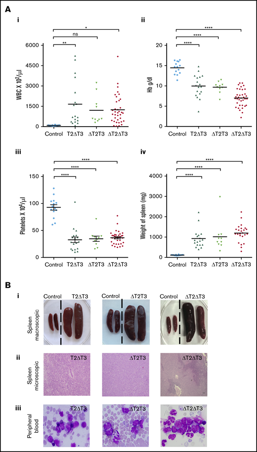 Characteristics of leukemia in T2ΔT3, ΔT2T3, and ΔT2ΔT3 mice. (A) WBC counts (i), hemoglobin levels (ii), and platelet counts (iii) of T2ΔT3 (n = 18), ΔT2T3 (n = 10), and ΔT2ΔT3 (n = 36) mice and of Mx1-Cre–Tet2f/fTet3f/w, Tet2f/wTet3f/f, or Tet2f/fTet3f/f mice (Control; n = 14), and spleen weights (iv) of T2ΔT3 (n = 18), ΔT2T3 (n = 10), and ΔT2ΔT3 (n = 24) mice and of control mice (n = 14). (Bi) Representative macroscopic photographs of spleen from leukemic T2ΔT3, ΔT2T3, and ΔT2ΔT3 mice. (Bii) Representative microscopic photographs showing obliteration of the normal spleen architecture in T2ΔT3, ΔT2T3, and ΔT2ΔT3 mice (hematoxylin and eosin stain; original magnification ×10). (Biii) Peripheral blood smear showing blast-like morphology from representative T2ΔT3, ΔT2T3, and ΔT2ΔT3 mice (Wright Giemsa stain; original magnification ×40). *P < .05, **P < .01, ****P < .0001. ns, not significant.
