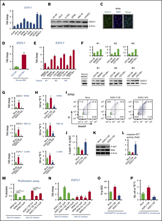 EGFL7 is a survival factor in myeloma cells (A) Fold change in EGFL7 gene expression of the human stromal cell line HS-5 and the MM cell lines U-266, RPMI8226, (abbreviated RPMI), MM.1S, H929, and KMS11, as determined by RT-PCR when compared with the EGFL7 expression in the human myeloid leukemia HL60 cells. (B) A representative western blot is shown for EGFL7, with b-ACTIN as a control, in tumor lysates from mice injected with indicated RPMI cells. (C) Representative images of RPMI8226 cells stained for EGFL7 (green fluorescence) and 4′,6-diamidino-2-phenylindole (DAPI; blue nuclear staining) by immunofluorescent staining. (D) Fold change in EGFL7 gene expression of MACS-isolated CD138+ cells from normal donors when compared with the EGFL7 expression in CD138− cells. (E) Fold change in EGFL7 gene expression as determined by RT-PCR in human cell samples of patients with MM (patients #1 and #2 MM patient sample at diagnosis and patient #3 MM patient sample at refractory stage of the disease; for more clinical details, see supplemental Figure 1) when compared with EGFL7 gene expression found in human BMMCs of healthy donors (n = 3/condition). (F) Western blot analysis of EGFL7 and b-ACTIN as a control in indicated cell population from healthy volunteers and patients with MM. (Upper) Band quantification using the ImageJ program. (Lower) Representative western blots of the same samples. (G-H) EGFL7 (EGFL OE), EGFL7 knockdown (KD), or Mock MM cells (RPMI8226, MM.1S, and U-266) were generated. (G) Fold change in EGFL7 gene expression when compared with Mock cells, as determined by RT-PCR (n = 3/condition). (H) Cells were counted 24 hours after cell seeding after trypan blue exclusion (n = 6/group). (I-J) RPMI8226 cells (OE, KD, Mock) were stained with Annexin V-FITC and PI and analyzed 48 hours after cell plating by FACS. (I) A representative FACS blot is shown for each condition (n = 6/group). (J) Percentage of Annexin V+ and PI− cells (as a measure of early and late apoptosis) by FACS after 48 hours (n = 3/group). (K) Representative western blot analysis of the expression of phosphorylated AKT, BAX, and b-ACTIN (control) in cell lysates of Mock, EGFL7 OE, and EGFL7 KD RPMI8226 cells. (L) Fold change in caspase 3/7 activity of EGFL7 OE or KD cells when compared with Mock RPMI8226 cells 48 hours after cell plating, as determined by Versa Max (n = 6/condition). (M-N) EGFL7 OE and wild-type (RPMI) cells were treated with various concentrations of the AKT1/2 inhibitor. (M) Proliferation was determined using the CCK-8 kit after 24 hours in culture. % Absorbance indicates the rate of viable cells (n = 6/condition). (N) Fold increase in EGFL7 expression after AKT1/2 inhibitor treatment when compared with EGFL7 expression in nontreated cells. (O-P) MM cells were cocultured with a confluent layer of GFPpos-EGFL7 Mock, EGFL7 OE, or EGFL7 KD ECs in direct contact, and the percentage of GFP-MM cells was determined after 24 hours of coculture (n = 3/condition). (O) Percentage of GFP− MM cells in the adherent fraction. (P) Absolute number of nonadherent suspension cells retrieved from the cocultures. As for RT-PCR data, transcripts were normalized to b-ACTIN. Graphs represent averages from 3 independently prepared templates per condition. Experiments were repeated twice with similar results. Data are represented as mean ± SEM. * P ≤ .05; ** P ≤ .01; *** P ≤ .001. P values were determined using a Student t test.