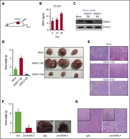EGFL7 augments MM growth in vivo. (A) Human RPMI8226 wild-type cells were injected s.c. into NOD/SCID mice (n = 6/group). (B) Human EGFL7 plasma levels were measured in murine plasma samples at indicated times by enzyme-linked immunosorbent assay in (n = 6). (C) Representative western blotting for EGFL7 and b-ACTIN in tumors extracted from tumors injected with Mock, EGFL7 OE, or KD RPMI8226 cells. (D-E) The size of tumors that formed after s.c. injection of Mock, EGFL7 OE, or KD cells after day 53. (D) Tumor weight was measured (left panel; n = 6/group). Representative macroscopic tumor images were taken on day 53 postinoculation (right panel). (E) Representative hematoxylin and eosin-stained tumor sections demonstrating increased necrotic areas (yellow lines) in tumors established with EGFL7 KD cells (scale bar, 200 µm). (F-G) RPMI8226 wild-type tumor-bearing NOD/SCID mice were injected with/without neutralizing Abs against EGFL7 (anti-EGFL7) starting after visible tumors had been established by day 25 (n = 6/group). (F) Tumor weight on day 53 after initial tumor inoculation (left panel). Representative macroscopic images of tumors (right panels). (G) Histological images of hematoxylin and eosin–stained tumor sections (scale bar of the insert, 100 µm). Graphs show mean ± SEM. Significance was calculated by Student t test, * P ≤ .05; ** P ≤ .01.