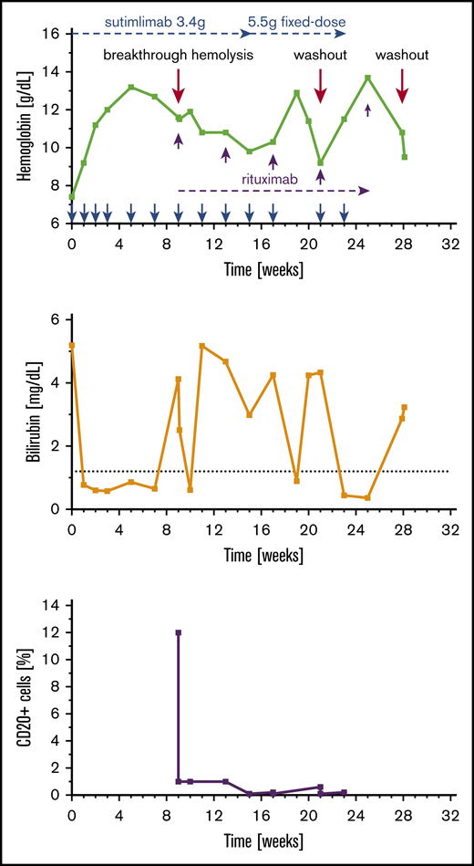 Laboratory course of patient 004. At treatment initiation, patient 004 had a hemoglobin level of 7.4 g/dL. She was started on 45 mg/kg (3.4 g) sutimlimab which rapidly abrogated hemolysis and increased her hemoglobin level by 5.8 g/dL over the course of 4 weeks. Patient 004 experienced laboratory evidence of breakthrough hemolysis after the sixth and seventh doses of sutimlimab. However, when blood sampling was performed 1 week after the seventh dose of sutimlimab, the hemoglobin level was slightly increased and the bilirubin level normalized, suggesting that the treatment effect of sutimlimab was sufficient for at least 7 days but not sufficient for an interval of 14 days. This indicates that either the dose needed to be increased or the dosing interval needed to be decreased to achieve a sustained treatment effect. Despite underdosing, patient 004 was deliberately continued on 45 mg/kg of sutimlimab to allow for the detection of a putative beneficial effect of concomitantly started treatment with rituximab. The patient was eventually switched to a 5.5-g fixed-dose regimen, resulting in a rapid increase of hemoglobin and a decrease of bilirubin. Patient 004 experienced a washout of sutimlimab after the second fixed dose and her hemoglobin dropped to 9.2 g/dL. However, after 2 infusion cycles of sutimlimab, her hemoglobin promptly increased again to a level of 11.5 g/dL. During a scheduled checkup 2 weeks later, her hemoglobin level had further increased by 2.2 g/dL to a peak level of 13.7 g/dL, concluding the NPP. The investigator decided to discontinue treating this patient because she had repeated falls as a result of unrelated hydrocephalus, which required a shunt operation. In spite of a fifth dose of rituximab administered after the NPP, patient 004 could not maintain normal hemoglobin levels. Her hemoglobin levels decreased by more than 4 g/dL within 3 weeks to a level of 9.5 g/dL and then ranged from 7.7 to 10.2 g/dL over the following months, eventually reaching a nadir of 7.3 g/dL 8 months later.