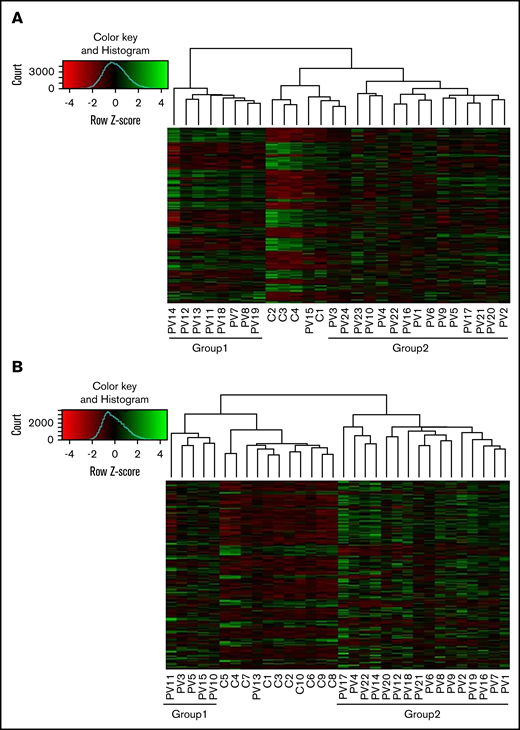 Differential expression of genes in granulocytes and platelets of PV patients compared with controls. Differentially expressed genes (adjusted P < .05; log2 fold change >1) in granulocytes (A) and platelets (B) of PV patients compared with controls were analyzed using the DEseq2 package. There were 2 groups in PV patients (group 1 and group 2). In granulocytes, patients in group 1 had less JAK2V617F positivity than those in group 2; whereas in platelets, there was no difference in JAK2V617F positivity, white blood cell counts, platelet counts, or type of treatment between group 1 and group 2.