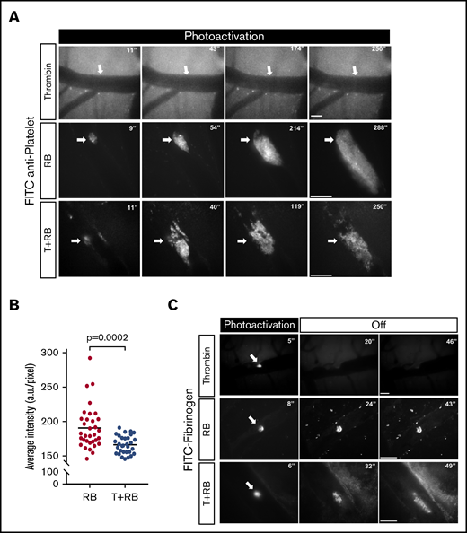 RB- and thrombin/RB-induced photothrombosis manifest divergent patterns of platelet aggregation and fibrin(ogen) extension. (A) Using DyLight488-conjugated anti-GPIbβ antibody to label platelets, intravital microscopy showed the lack of platelet aggregation after systemic intravenous injection of 80 U/kg thrombin and laser photoactivation (supplemental Video 2; n = 3). In contrast, photoactivation after intravenous injection of RB (50 mg/kg) or thrombin/RB (T+RB) induced platelet aggregates of different compactness (see also supplemental Videos 3 and 4, respectively). Arrows indicate the site of photoactivation. (B) Imaging analysis showed a lower average intensity of anti-GPIbβ/platelet fluorescence signals in the T+RB clots (n = 33 in 8 mice) than in RB photothrombosis clots (n = 31 in 6 mice; P = .0002 by unpaired Student t test). (C) Intravital microscopy of FITC-conjugated fibrinogen showed the lack of fibrin(ogen) extension after photoactivation in thrombin-alone injection (supplemental Video 5) and restricted fibrin(ogen) deposits after RB photothrombosis (supplemental Video 6), in contrast to appreciable expansion of fibrin(ogen) deposits in T+RB photothrombosis (supplemental Video 7; n = 3 for each group). Scale bars, 50 μm.