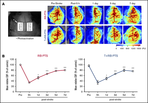 LSCI showed gradual recovery of blood flow in the peripheral ischemic area from 1 day after RB-PTS or T+RB-PTS. (A) The CBF was sequentially measured by LSCI before and after photothrombosis plus ligation of the ipsilateral common carotid artery (from 5 hours to 7 days postphotoactivation), and quantified as the percentage to contralateral hemisphere at each time. Shown are the representative LSCI images at various points after RB-PTS and T+RB-PTS (n = 7 for each group). Also shown are the MCA-suppling territory for CBF measurement (3 mm × 4.8 mm) in both hemispheres. Asterisk indicates the site of proximal MCA-directed photoactivation (1 mm in diameter). Arrow indicates the direction of MCA blood flow. (B) The blood flow in the ipsilateral MCA-supplying territory dropped at 5 hours after photoactivation, but steadily recovered to ∼50% at 1 day (*P < .05 compared with the 5-hour postphotoactivation value by 1-way analysis of variance), ∼65% at 3 days (***P < .001 compared with the 5-hour value by 1-way analysis of variance), and ∼80% at both 5 and 7 days (***) in both RB-PTS and T+RB-PTS models (n = 7 in each group).
