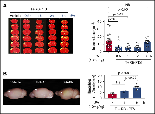 Acute infusion of tPA (within 2 hours after photoactivation) reduces the infarct size in T+RB-PTS model. (A) The representative TTC-stained brain slices from mice receiving the vehicle or 10 mg/kg tPA at the indicated time after T+RB-PTS. Quantification showed more than 50% reduction of the infarct size in 0.5-hour tPA-treated (6.7 ± 2.1 mm3; n = 9; P < .05 by 1-way analysis of variance), 1-hour tPA-treated (4.6 ± 1.0 mm3; n = 10; P < .01), and 2-hour tPA-treated (6.4 ± 1.5 mm3; n = 8; P < .05) group, but not in the 6-hour tPA-treated group (15.2 ± 3.1 mm3; n = 7), compared with the vehicle-treated group (14.8 ± 2 mm3; n = 19). Normal distribution of the infarct size in each group was ascertained by the Komogorov-Smirnov normality test. (B) The representative images of brain surface in mice treated by vehicle, 1-hour tPA, or 6-hour PA at 24 hours after T+RB-PTS. Note the more pronounced hemorrhage spot (indicated by arrow) in the MCA-supplying territory in the mice that received the delayed, 6-hour tPA treatment. Quantification of cerebral hemorrhage indicated a higher content of hemoglobin in 6-hour tPA photothrombosis (9.6 ± 0.9 μL; n = 7) than in the vehicle (4.0 ± 0.5 μL; n = 5) or 1-hour tPA-treated (6.2 ± 0.4 μL; n = 3) groups.