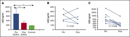 Circulating paired soluble LAG3 levels in patients with DLBCL. (A) Paired soluble LAG3 levels at diagnosis (Pre) and after 4 cycles of R-CHOP (Post) compared with healthy subjects (Controls). (B) Paired soluble LAG3 levels in patients whose interim PET/computed tomography (CT) remained positive after 4 cycles of R-CHOP. (C) Paired soluble LAG3 levels in patients whose interim PET/CT was negative after 4 cycles of R-CHOP. *P < .05, **P < .01.