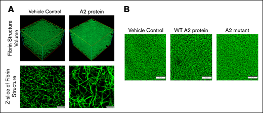 The effect of the A2 protein on the fibrin clot structure. (A) Confocal microscopy images of fibrin clots at a magnification of ×200 formed in plasma from healthy human donors. Note that the effect of the A2 protein (0.25 μM) on the resultant clot structure (right) is evident as compared with plasma incubated with vehicle control (left). Scale bars, 10 μM. (B) The WT A2 protein clearly altered the resultant fibrin structure as compared with plasma treated with vehicle control and the A2 mutant. Scale bars, 50 μM.