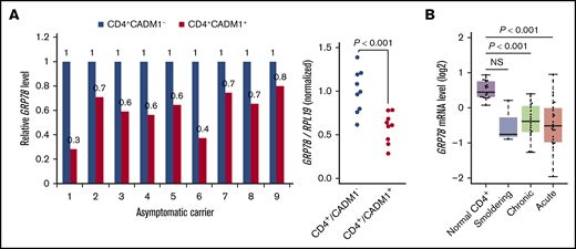 GRP78 expression is downregulated in the HTLV-1–infected cell population. (A) GRP78 mRNA expression levels in HTLV-1–carrier PBMCs (n = 9). The gene expression ratio of the CD4+CADM1+ cell population relative to the CD4+CADM1− cell population is shown. The bar graph is shown as a dot plot. (B) Box plots showing GRP78 mRNA expression levels in PBMCs from patients with ATL (smoldering, n = 3; chronic, n = 20; acute, n = 26) with the indicated type and control healthy individual CD4+ cells (n = 21). The expression levels were evaluated from a dataset deposited in the NCBI GEO Web site. NS, not significant.