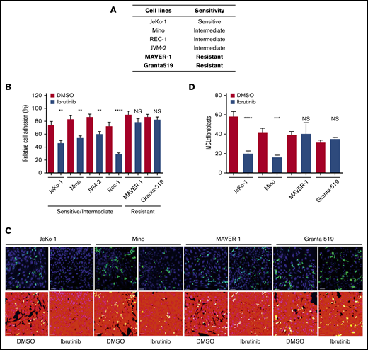 Cell adhesion is impaired by ibrutinib in ibrutinib-sensitive cell lines, but not in ibrutinib-resistant cell lines. (A) Sensitivity of MCL cell lines to ibrutinib according to both cell growth and MTT assay.33 (B) Cell adhesion assay of various MCL cell lines treated with ibrutinib. MCL cells were fluorescently labeled with anti-IgM antibody and allowed to adhere to unlabeled pre-plated NKTert cells in the presence or absence of ibrutinib 400 nM. After 24 hours of culture, plates were washed with saline, and attached and labeled MCL cells were then counted. Data shown represent 1 of the 3 independent experiments. Error bars represent mean ± SEM of 6 replicate reactions. (C) Confocal microscopy images of MCL (green) cells and BMF (red) cells after treatment with DMSO or ibrutinib 400 nM for 24 hours. DAPI staining was added to aid with cell counting. Scale bar, 50 µm. A 3 × 3 montage with z-stack was performed for 4 random fields per treatment. The assay was repeated twice in duplicate. (D) Quantitation of confocal images using the ImageJ cell counter (National Institutes of Health, Bethesda, MD). MCL and BMFs were counterstained with DAPI, and all nuclei were counted. The MCL cells were manually counted by using the cell counter plug-in. The number of BMFs per field was determined by subtracting the number of MCL (green) cells from the total number of nuclei. The ratio of MCL:BMFs was then calculated as a measure of cell adhesion. Error bars represent mean ± SEM. Statistical analysis was done by using an unpaired Student t test. **P < .01; ***P < .0005; ****P < .0001. NS, not significant.