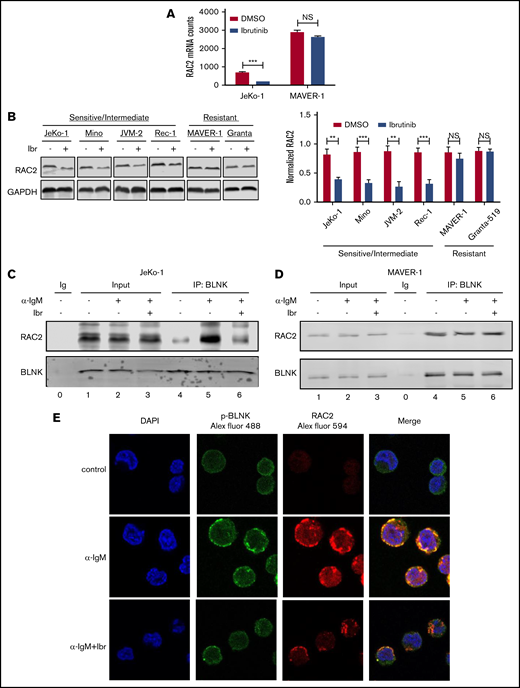 Expression and BLNK association of RAC2 are downregulated by ibrutinib in sensitive cells but not in resistant cells. (A) Expression of RAC2 mRNA in JeKo-1 vs MAVER-1, extracted from the RNA-Seq data. (B) Immunoblot of RAC2 in MCL cell lines. Cells were treated with either 400 nM of ibrutinib or DMSO for 24 hours. Gel picture in the left panel represents 1 of the 3 independent experiments that were quantified by the bar graph shown on the right. Integrated optical density of RAC2 is normalized to that of glyceraldehyde-3-phosphate dehydrogenase (GAPDH). (C-D) Immunoblotting of coimmunoprecipitation products. Cells were preincubated with or without 400 nM of ibrutinib for 1 hour and stimulated with or without anti-IgM antibody for 15 minutes before cell lysis. Immunoblotting was performed for at least 3 times using either whole-cell extracts (Input) or anti-BLNK pull-downs in JeKo-1 (C), and MAVER-1 (D). (E) Colocalization of p-BLNK and RAC2 by confocal microscopy in JeKo-1 cells. Immunofluorescent-labeled antibodies and cell treatment conditions are indicated. Cells were treated with ibrutinib for 6 hours before the αIgM stimulation. **P < .01; ***P < .001.