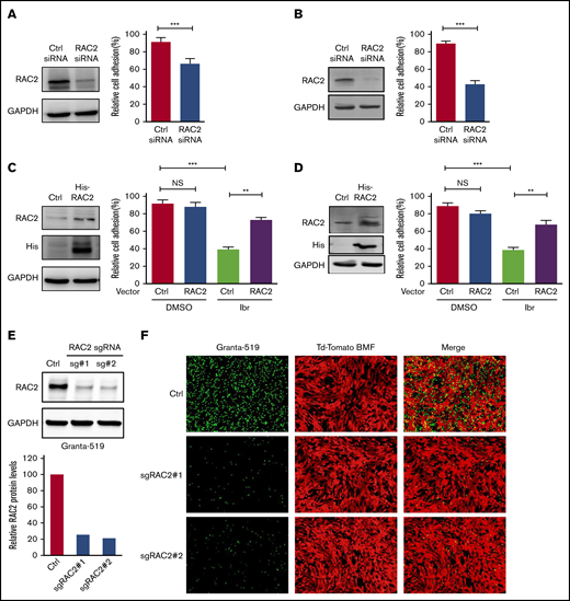 RAC2 regulates cell adhesion in MCL. (A) JeKo-1 cells. Left: RAC2 siRNA effectively reduced RAC2 protein level compared with control siRNA. Right: cell adhesion to NKTert cells was significantly compromised. Cells were cocultured with NKTert and allowed to adhere for 24 hours before washing. Error bar represents mean ± SEM of 6 replicate reactions. (B) Same experiment as in panel A with Mino cells. (C) JeKo-1 cells. Left: exogenous expression of His-tagged RAC2 in JeKo-1 cells. Immunoblots for RAC2 and His-tag are shown. Glyceraldehyde-3-phosphate dehydrogenase (GAPDH) was included as the loading control. Right: exogenous RAC2 reversed ibrutinib-induced cell adhesion impairment. (D) Same experiment as in panel A with Mino cells. Error bar represents mean ± SEM of 6 replicate reactions. (E) RAC2 single-guide RNAs (sgRNAs) effectively reduced RAC2 protein levels in Granta-519 cells compared with control cells. (F) Representative fluorescent microscopic photos showing that RAC2 knockout significantly compromised adhesion of Granta-519 cells (green) to tdTomato-BMF cells (red). **P < .01; ***P < .001.