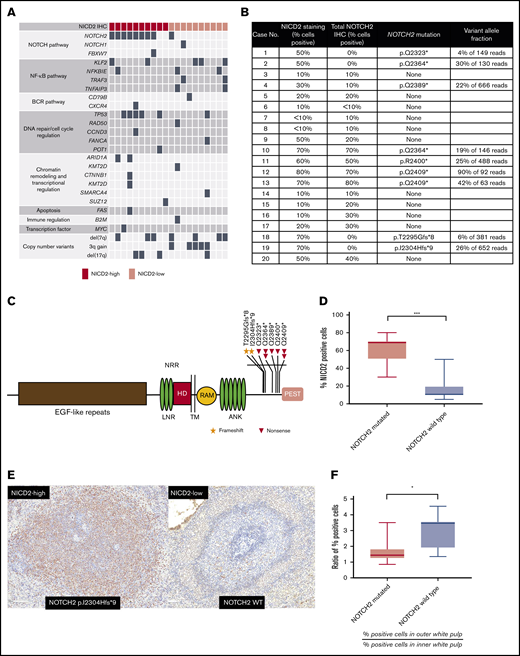 NOTCH2 mutation is associated with higher levels and wider distribution of NICD2 staining in SMZL. (A) Summary of pathogenic single-nucleotide, copy-number, and structural variants identified in 20 cases of SMZL. (B) Summary of NICD2 staining and NOTCH2 mutation status of genotyped SMZL cases. (C) Schematic of NOTCH2 mutations in SMZL. (D) Box-and-whisker plot showing frequency of NICD2+ cells in NOTCH2-mutated and wild-type SMZL (***P < .001). (E) Representative staining for NICD2 in NOTCH2-mutated and wild-type SMZL (original magnification, ×200). (F) Ratio of NICD2+ cells in outer and inner white pulp in NOTCH2-mutated vs wild-type cases (*P < .05). ANK, Ankyrin repeat; EGF, epidermal growth factor; HD, heterodimerization domain; LNR, Lin12/Notch repeat; RAM, RBP-Jκ/CBF1-associated module; TM, transmembrane domain.