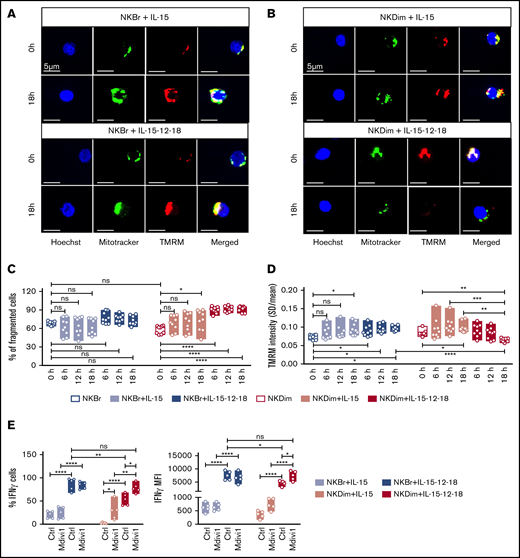 Divergent changes in mitochondrial morphology accompany activation of NKBr vs NKDim cells. (A-D) Freshly sorted NKDim and NKBr cells were stained with Mitotracker green and TMRM and imaged by confocal microscopy (0 hours). Cytokines were added to the medium as indicated in the figures, and images were taken every 6 hours. . (C-D) Mitochondrial fragmentation (C) and total TMRM intensity (D) at different time points for NKBr and NKDim cells. Circles are technical replicates from 3 HDs. (E) Primed or activated NKBr and NKDim cells were cultured for 18 hours ± Mdivi-1 (25 μM). Expression of IFN-γ was monitored by fluorescence-activated cell sorting; data from 3 independent experiments with at least 2 donors each). P > .05 was considered not significant (ns). *P < .05, **P < .01, ***P < .001, ****P < .0001 using 1-way analysis of variance with Tukey’s correction.