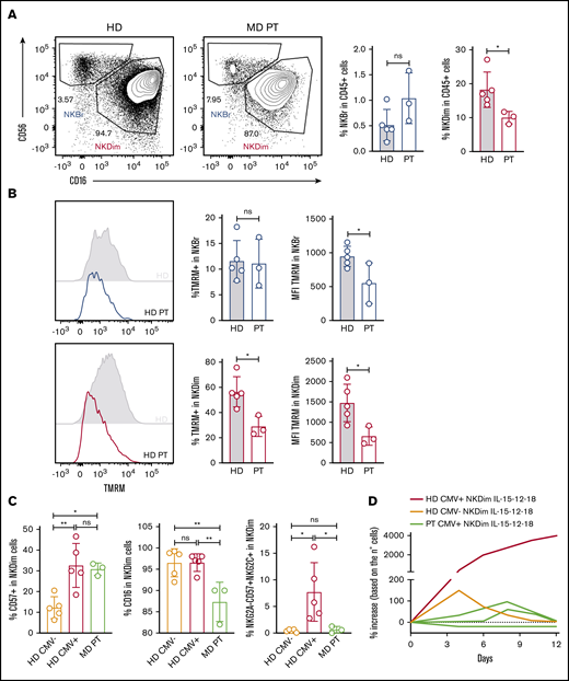 NK cells from MD patients have loss of memory-like NK cells and showed reduced cellular fitness. (A) Representative plots of NKBr and NKDim cells in HDs and MD patients with OPA1 mutation. Percentage of NKBr and NKDim cells in CD45+ cells. (B) Representative histograms of mitochondrial polarization in NKDim and NKBr cells comparing HDs and MD patients. Percentage of TMRM+ cells and TMRM intensity in NKBr and NKDim cells. (C) HDs and MD patients were compared with 5 CMV+ HDs by fluorescence-activated cell sorting (FACS). FACS analysis of the percentage of CD57+, CD16+, and CD57+NKG2A−NKG2C+ cells in NKDim cells. (D) Cells from 2 HDs and 3 MD patients were cultured in IL-15/12/18 for 12 days. Percentage of increase was calculated based on the number of cells (red, CMV+ HD; orange, CMV− HD; green, MD patients; data summarized from 2 independent experiments with at least 2 HDs each and 3 MD patients). P > .05 was considered not significant (ns). *P < .05, **P < .01 using 1-way analysis of variance with Tukey’s correction.